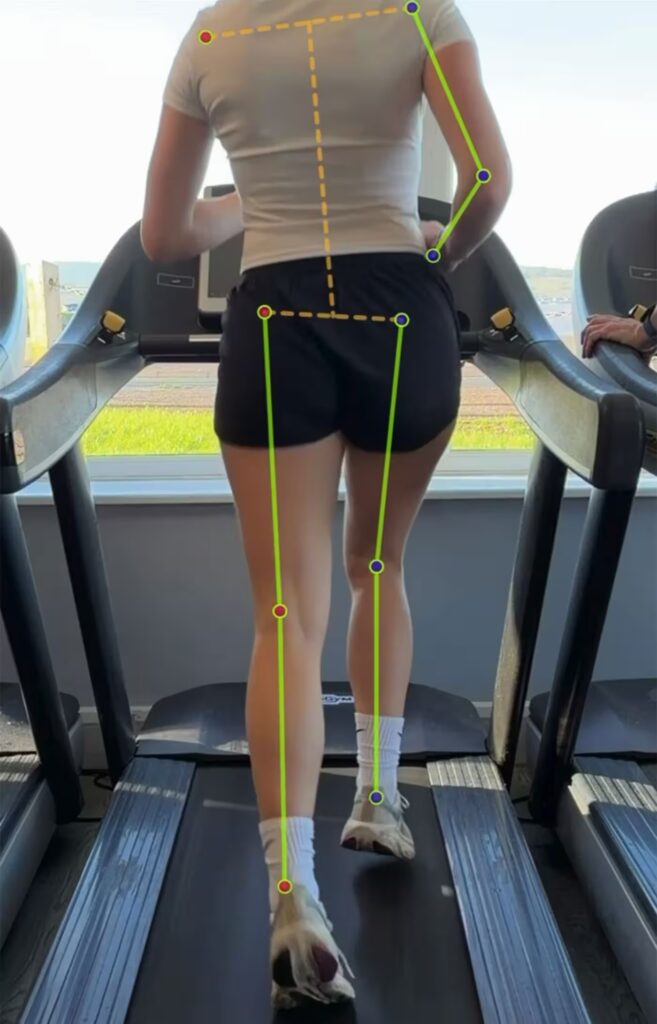 Running Gait Analysis - Osteo & Physio